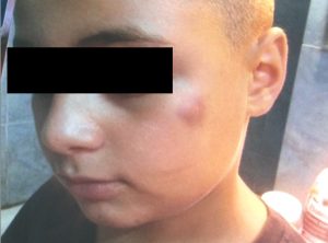 PĂRINŢII UNUI ELEV ACUZĂ ÎNVĂŢĂTOAREA DE RELE TRATAMENTE. CADRUL DIDACTIC RESPINGE ACUZAŢIILE