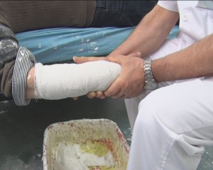 AGLOMERAT LA ORTOPEDIE. ZECI DE FRACTURI DIAGNOSTICATE