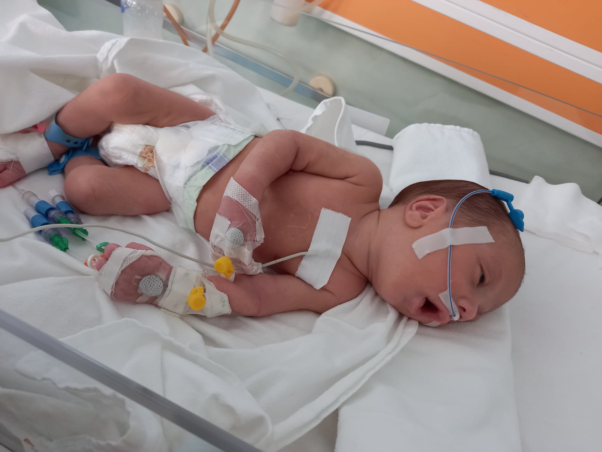 SĂ-I DĂM O ȘANSĂ MICUȚULUI EDUARD GABRIEL! La nici două luni, bebelușul suferă de o boală rară