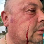 (UPDATE/FOTO) Candidat agresat de un apropiat al primarului? ,,Confruntare de idei, nu de pumni"