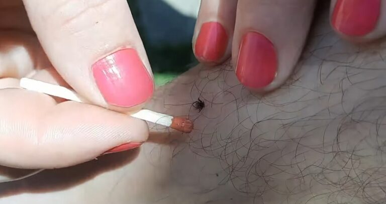 A început sezonul căpușelor! 15 persoane au ajuns la UPU, doar în ultima săptămână